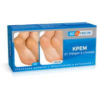Krém na Päty a Chodidlá 150ml